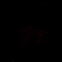 17PCW human midbrain